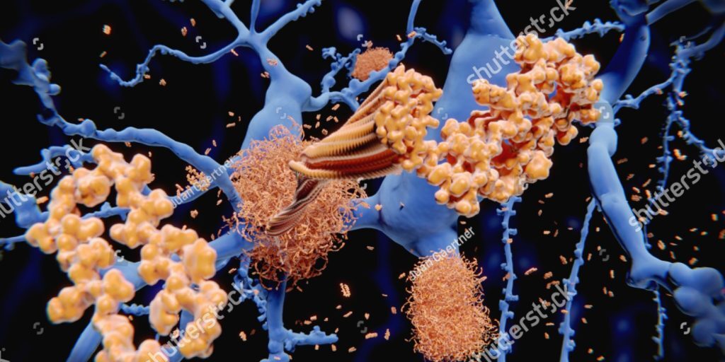 stock-photo-alzheimer-s-disease-the-amyloid-beta-peptide-accumulates-to-amyloid-fibrils-that-build-up-dense-1157052994
